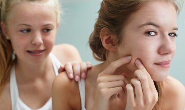 Диета при гормональных и подростковых угрях